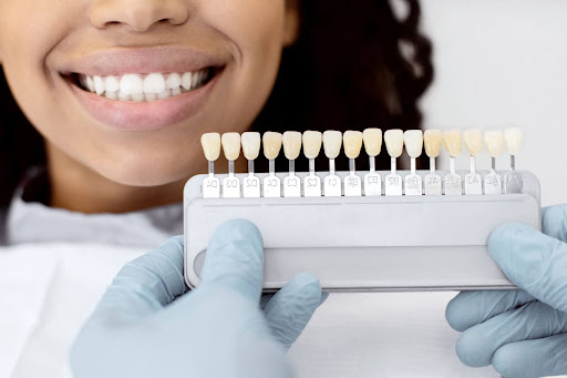 A woman at a dentist is getting her teeth shades matched.